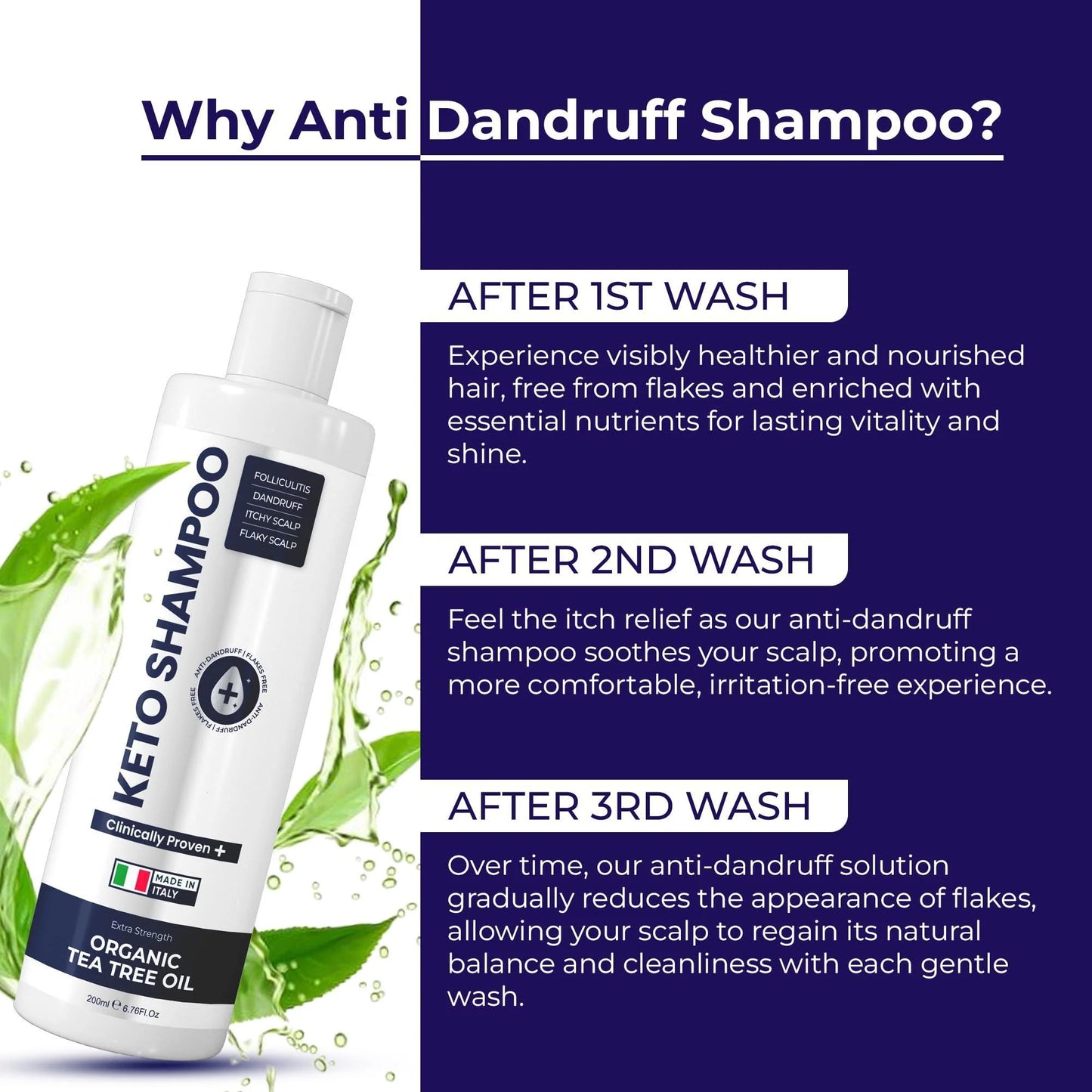 Anti Dandruff Shampoo Pack 2 with Scalp Brush Sulfate Free Medicated Clarifying