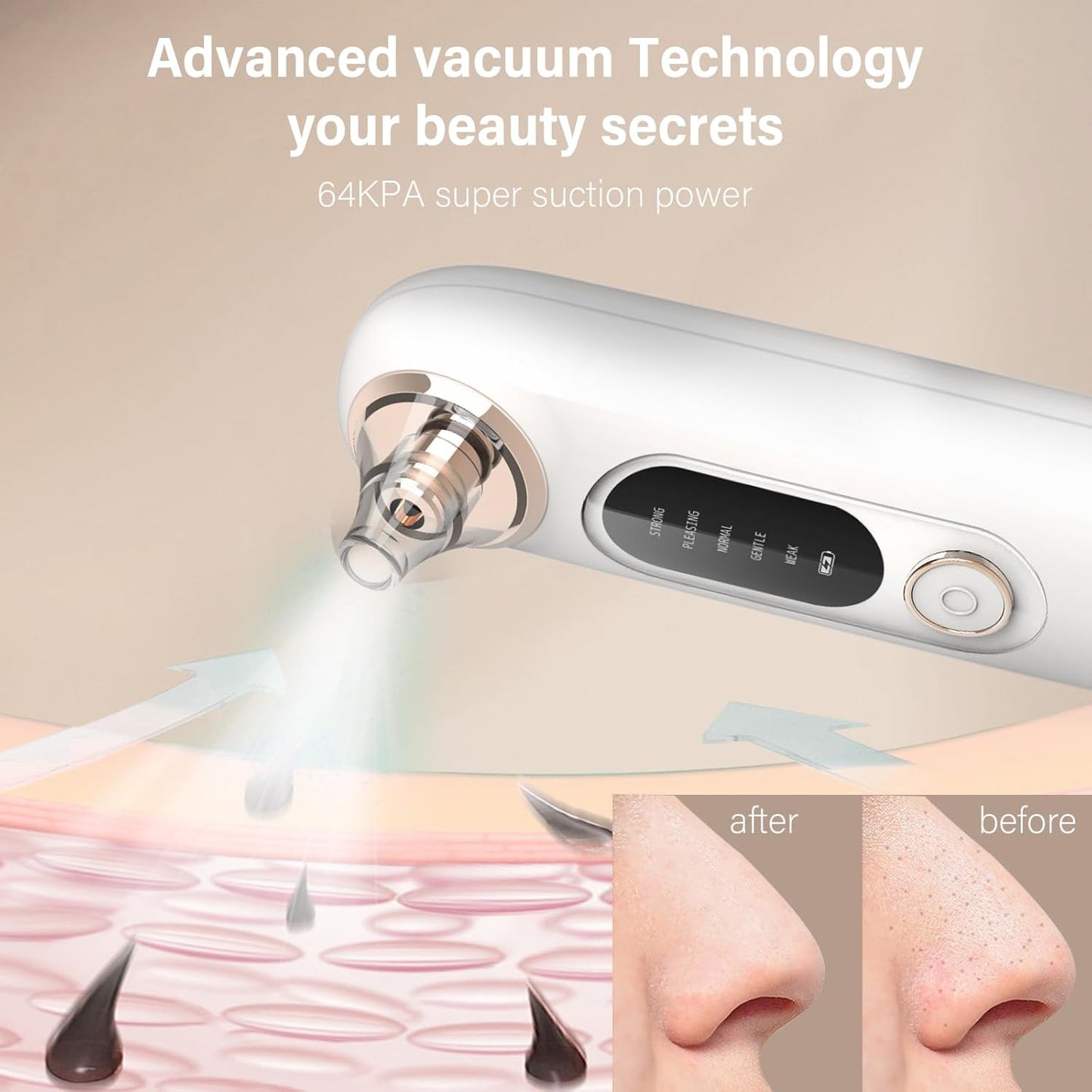 Blackhead Remover Pore Vacuum Kit for Face, 5 Adjustable Suction Levels Blackhead Extraction Tool, Face Suction Pore Cleaner with 4 Suction Heads, 4 Probes for Women & Men(White