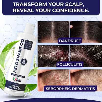 Anti Dandruff Shampoo Pack 2 with Scalp Brush Sulfate Free Medicated Clarifying